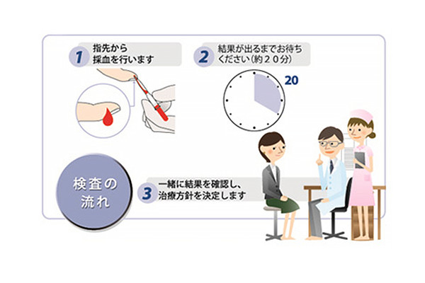 アレルギー性結膜炎