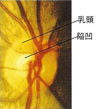 正常