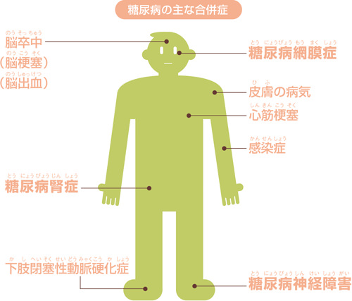 糖尿病の合併症