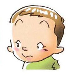 斜視とは？